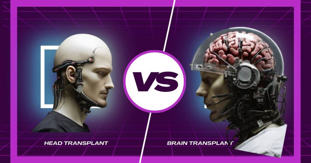 Brain Transplant