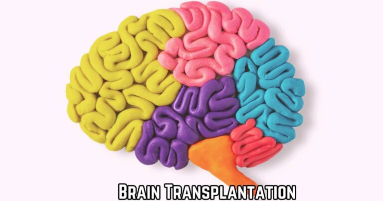 Brain Transplant 101: Everything You Need to Know